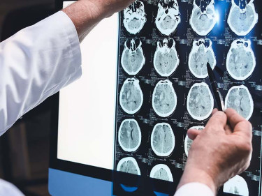 Male doctor assesses a scan for evidence of brain injuries.