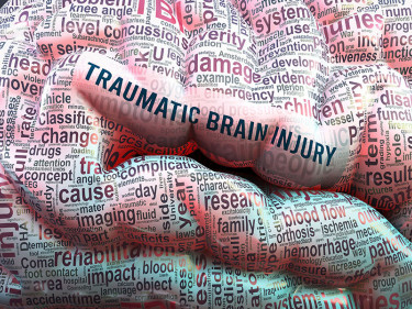 A brain with the words “traumatic brain injury” written on it, signifying the importance of a brain injury lawyer.