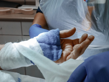 Nurses wrapping burn injury