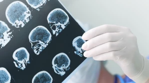 Gloved medical professional holding brain CT scan films showing cross-sectional skull and cranial imaging