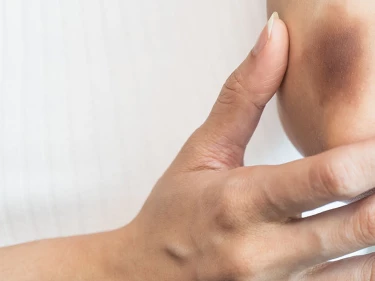 A woman with a soft tissue injury.